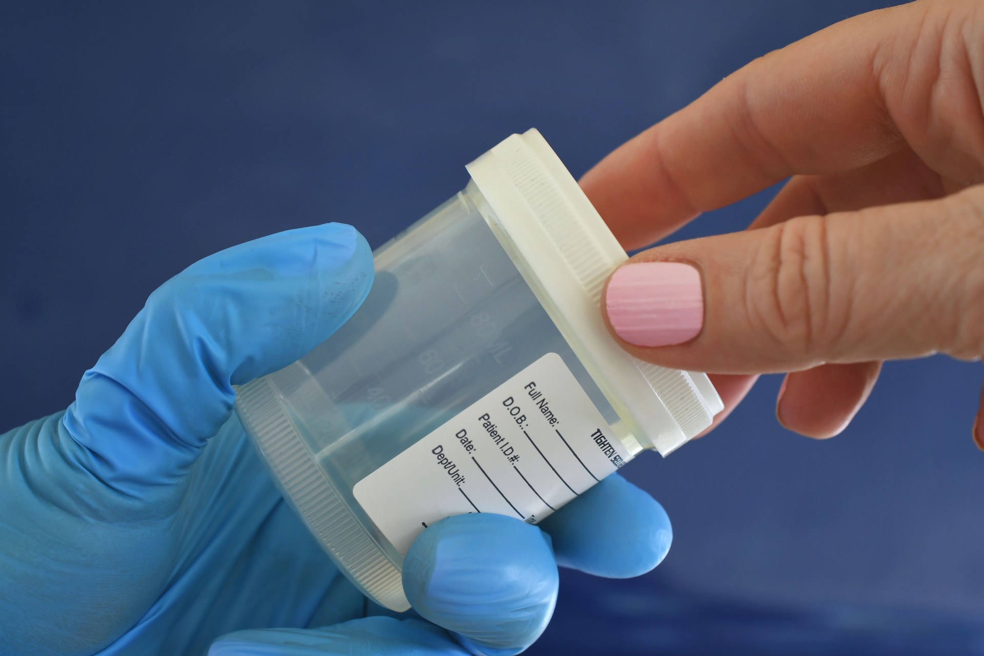 Urine Sample specimen cup
